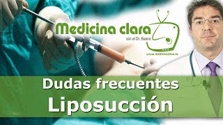 Liposucción: lipoescultura, liposucción ultrasonidos y liposucción láser miniatura