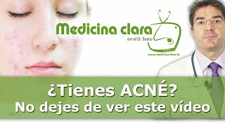 ¿Se puede curar el acné? Tratamiento y curación del acné miniatura